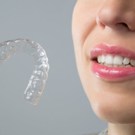 Invisalign